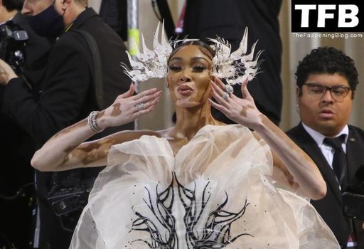 Winnie Harlow